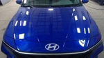 Hood 66400AA000 Fits 21-25 Hyundai Elantra 3193383. Fixed Price $964.00.